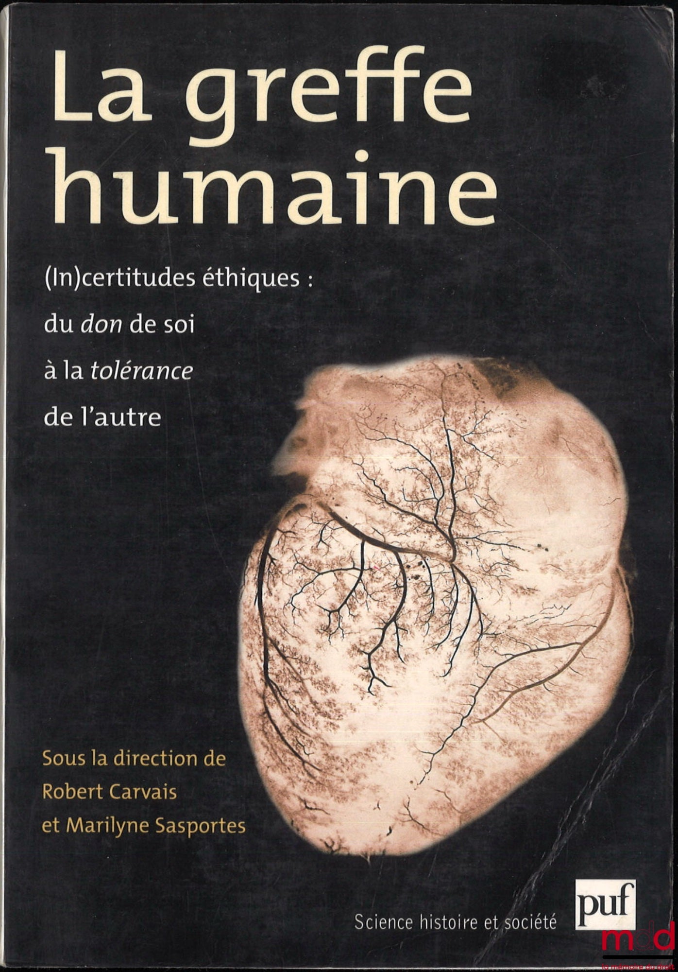 [Collectif] – LA GREFFE HUMAINE, (In)certitudes éthiques : du don de soi à la tolérance de l’autre, Dialogue pluridisciplinaire sur « La greffe, le don et le société », sous la dir. de Robert Carvais et Marilyne Sasportes, Préface de Jean Bernard